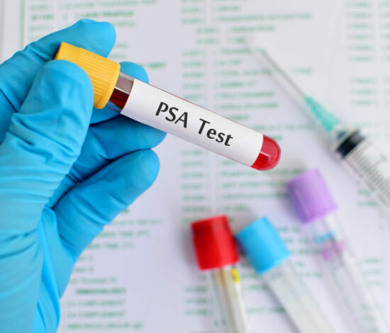 Test PSA